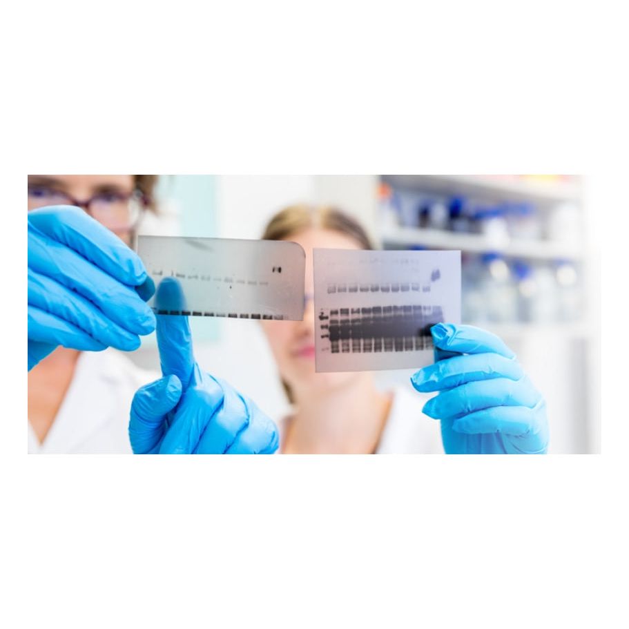 トランスファーメンブレン ポリフッ化ビニリデン(PVDF)